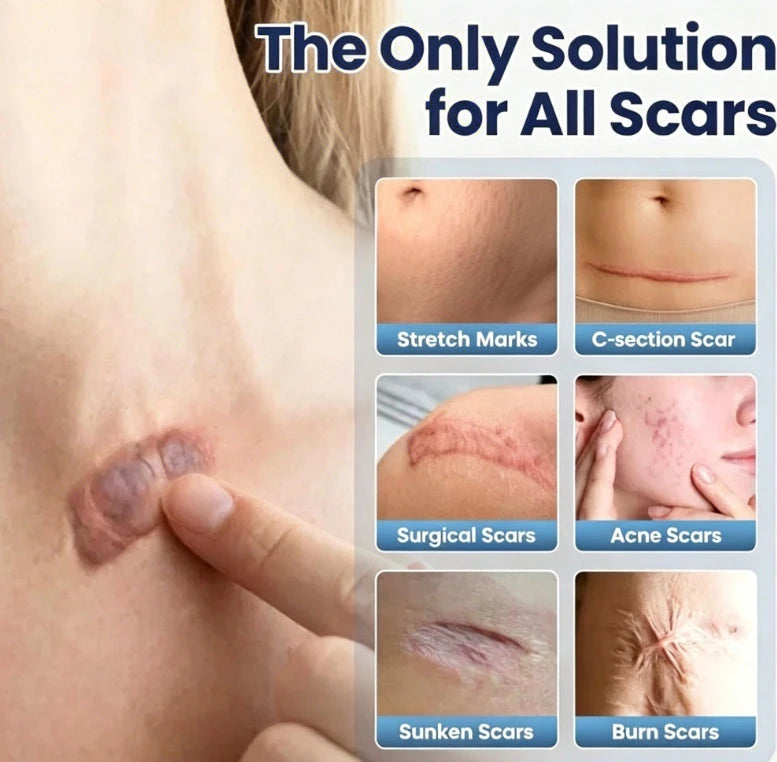 Scar Repair Cream