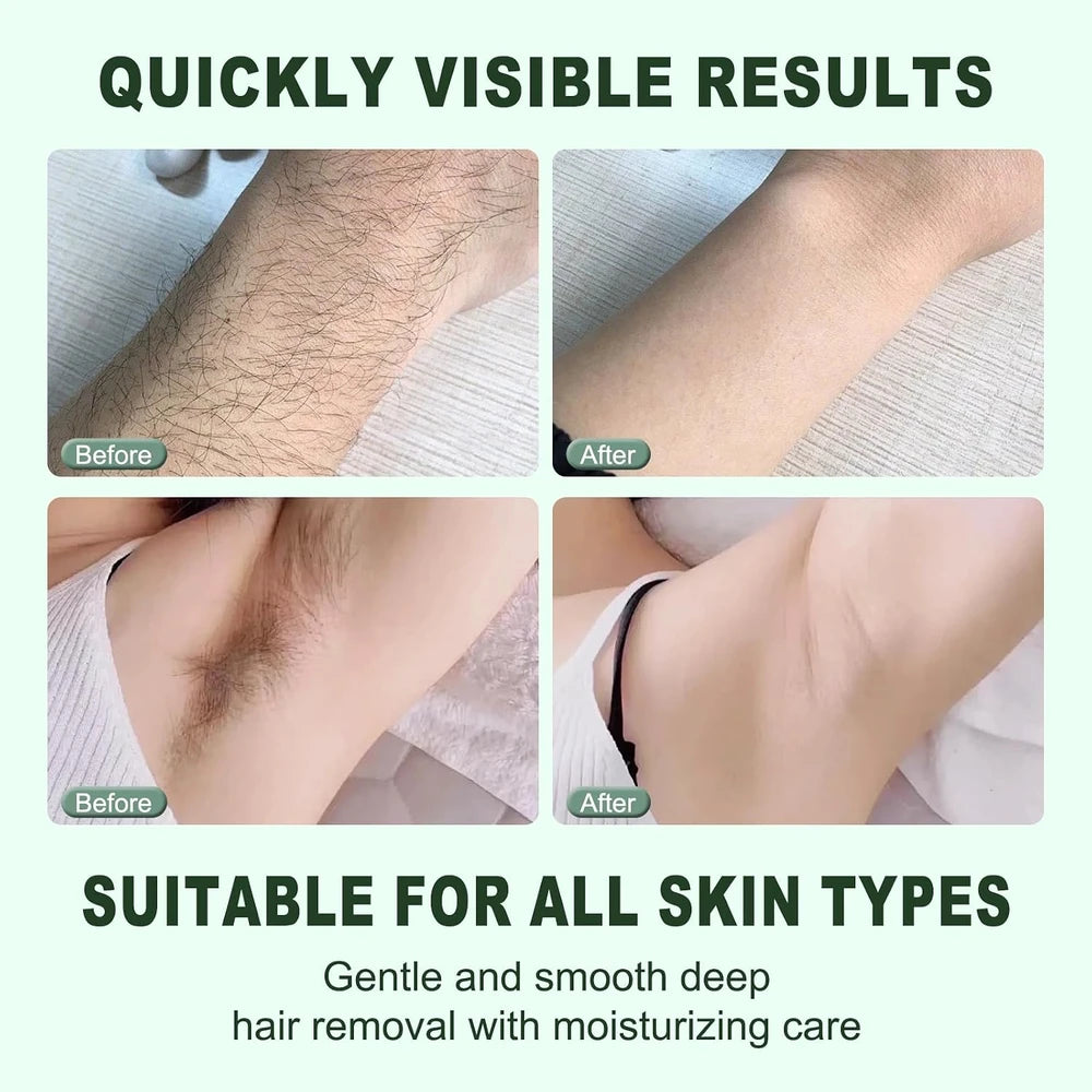 Hair Removal Cream