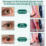 Ceoerty OptiClear Nano Eye Roller Serum