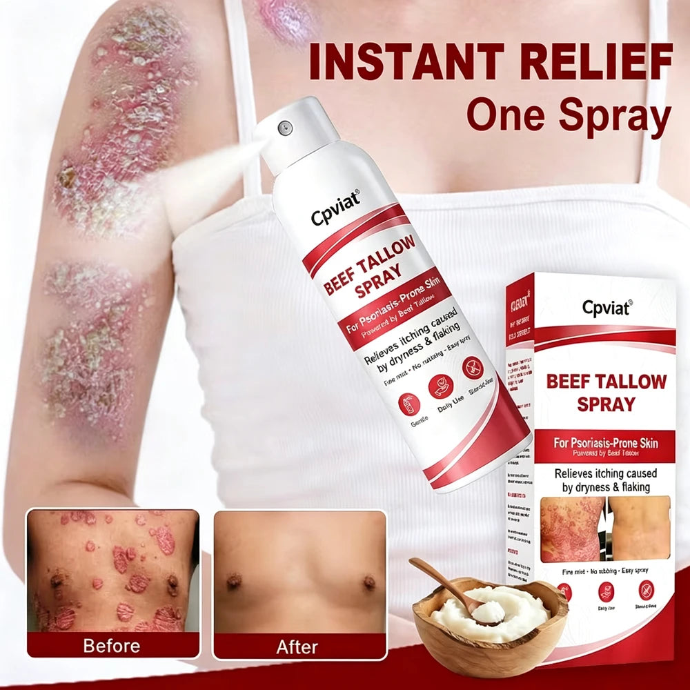 Beef Tallow Itch Relief Spray