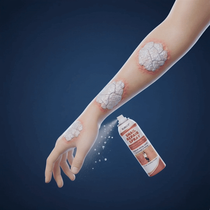 Beef Tallow Itch Relief Spray