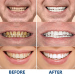 Hydroxyapatite  Repair Toothpaste