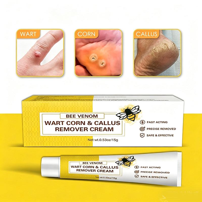 Bee Venom Corn and Callus Removal Cream | Soft Heels for Sandals