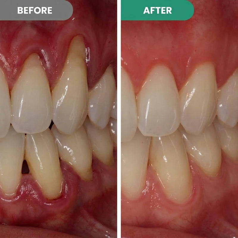 Dentora Advanced Gum Care Gel