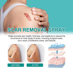 Advanced Scar Spray