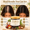 Zova Hair Growth Balm